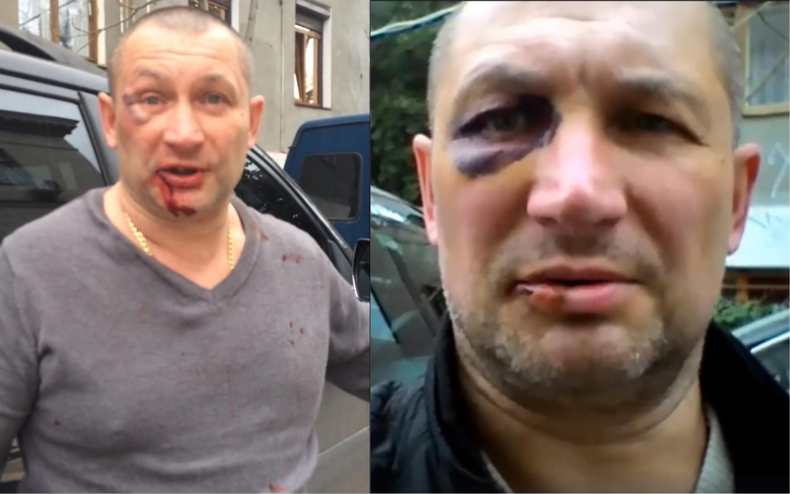 У Криму сильно побили українця через синьо-жовті кольори на авто: відео