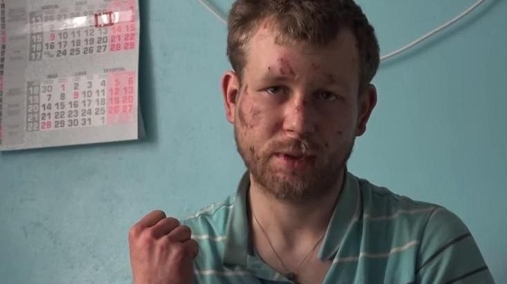 Депутат под Мариуполем приковывал цепями своего работника: ужасные детали