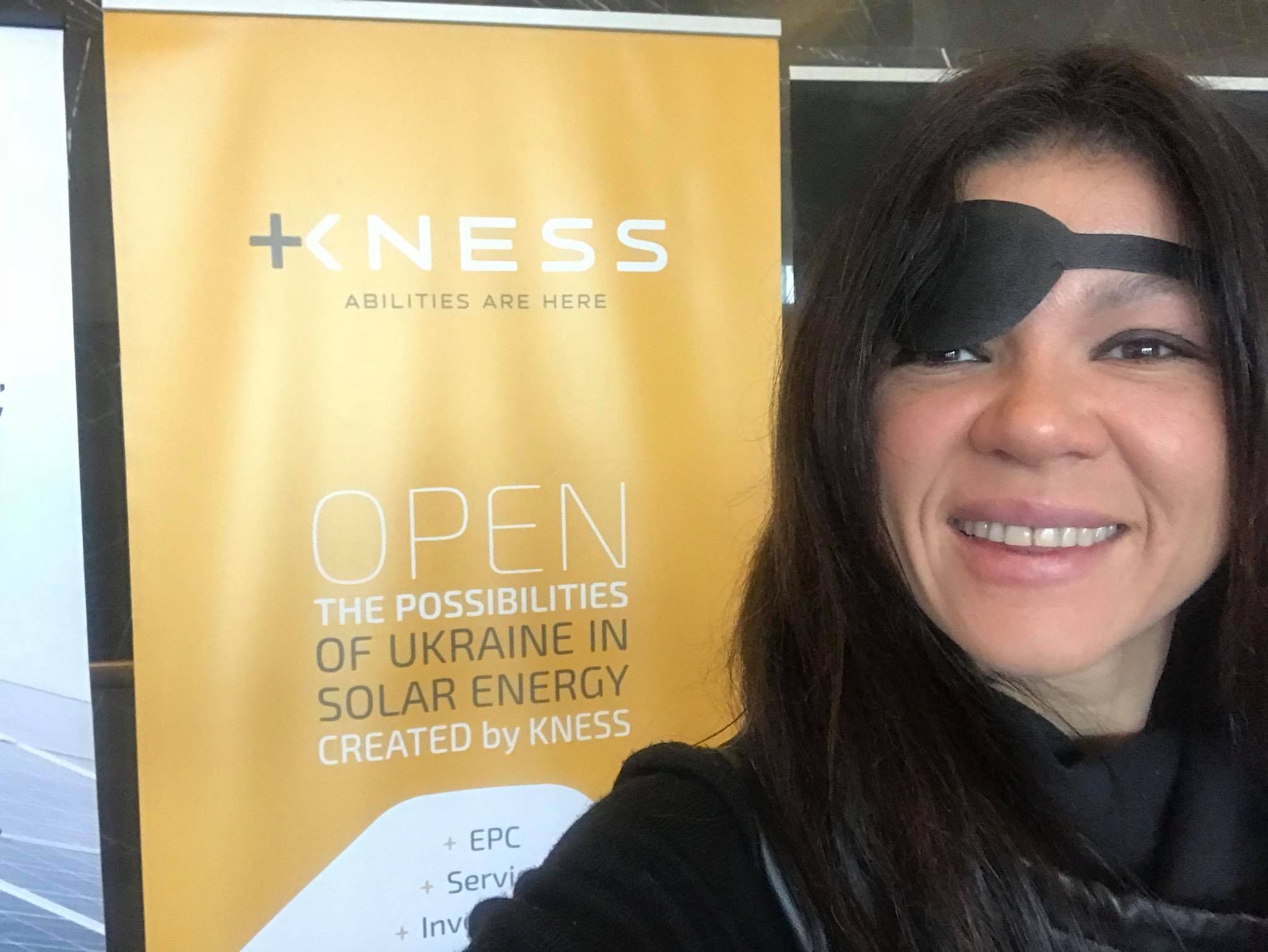 Співачка Руслана розбила голову напередодні конференції: фото Співачка Руслана розбила голову напередодні конференції: фото