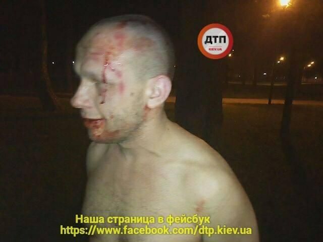 В Киеве боец бросил гранату во время драки: фото