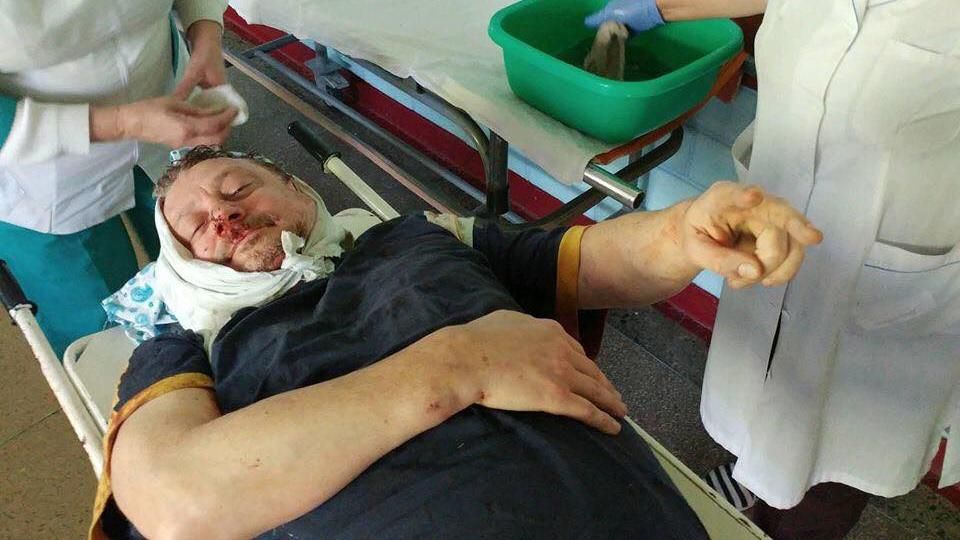 На Полтавщине жестоко избили соратника Саакашвили: у мужчины многочисленные переломы