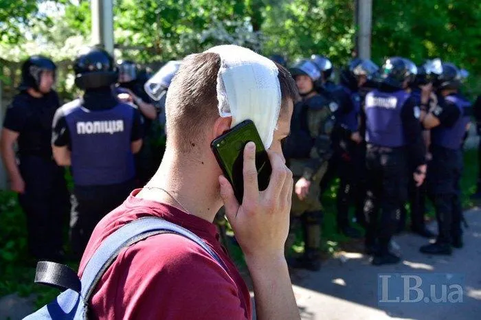 Мазилюк, журналіст, сутички, Нацкорпус, Нацгвардія, Льовчкін, Інтер, Київ 