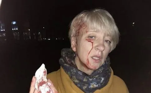 Напад на суддю Гольник Напад на суддю Гольник