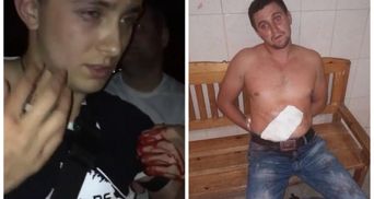 Покушение на Стерненко: нападавшего освободили из-под ареста