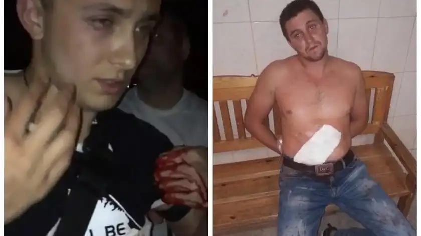 Покушение на Стерненко: нападавшего освободили из-под ареста