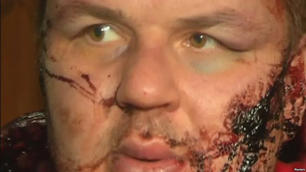 Ушкодження Булатова Ушкодження Булатова