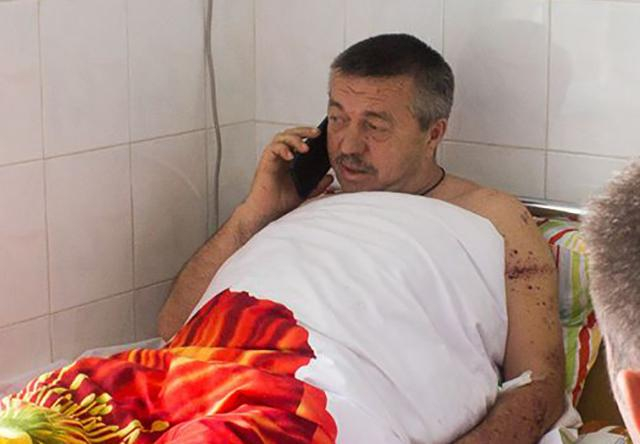 Стрельба в депутата в Одесской области: известно имя пострадавшего, опубликованы фото