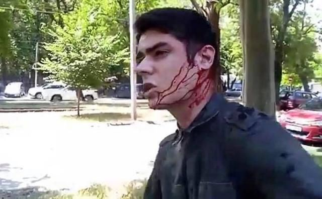В Одесі напали з ножем на місцевого активіста Устименка: фото і відео