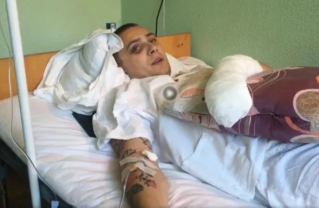 Сергій Стерненко після нападу Сергій Стерненко після нападу