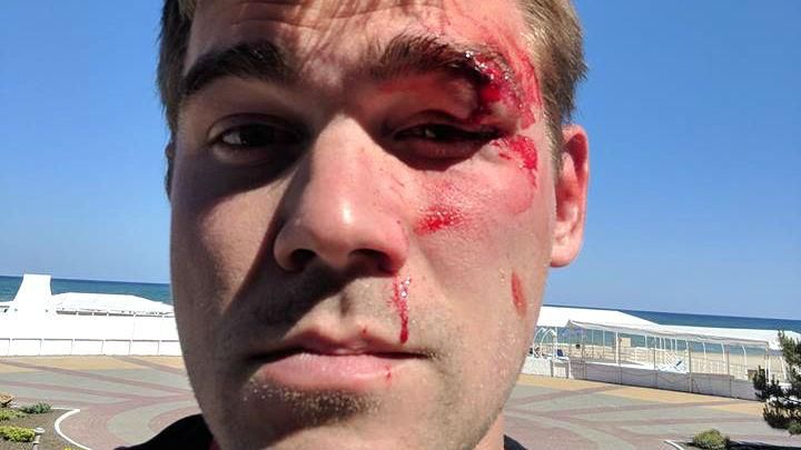 Скандал в интернет-магазине STYLUS.ua: владелец сервиса избил возмущенного пользователя Скандал в интернет-магазине STYLUS.ua: владелец сервиса избил возмущенного пользователя