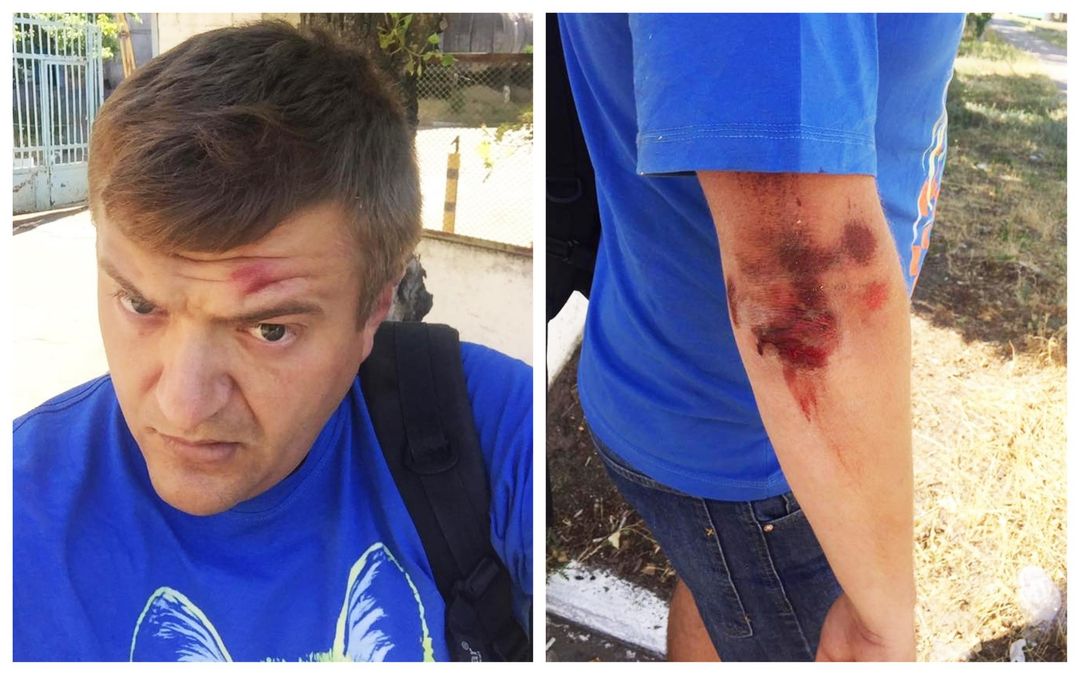 Напад на журналіста в Херсоні: чоловік розповів подробиці про своїх кривдників і показав фото