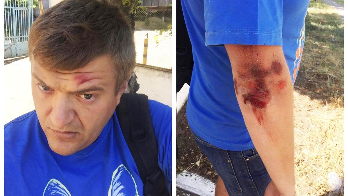 Нападение на журналиста в Херсоне: мужчина рассказал о своих обидчиках и показал фото Нападение на журналиста в Херсоне: мужчина рассказал о своих обидчиках и показал фото
