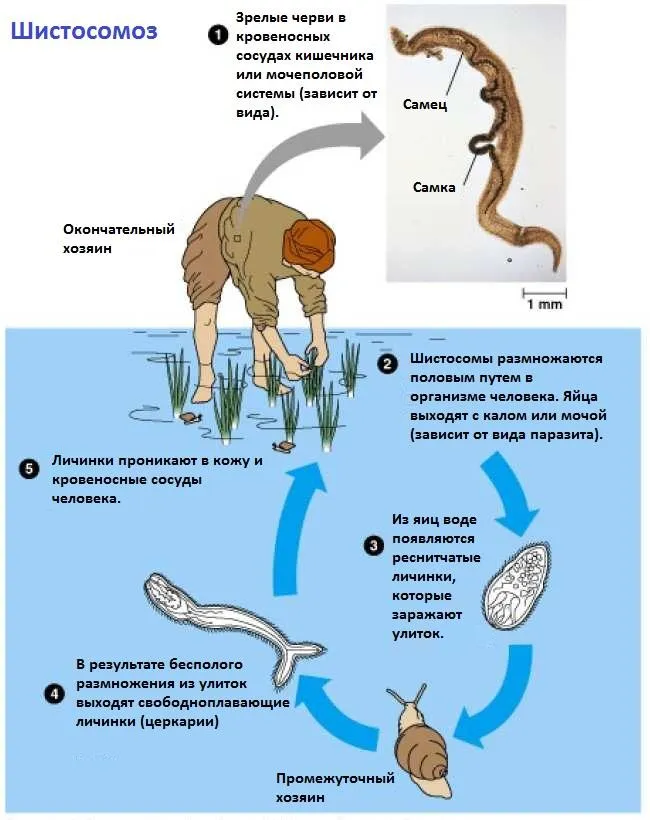 шистосомоз