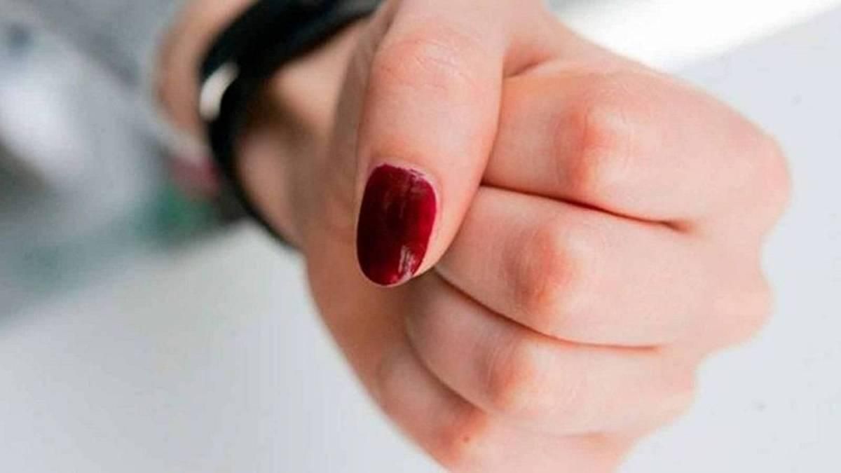 В Херсоне жена депутата от "Опоблока" побила активистку "Самопомочи" В Херсоне жена депутата от "Опоблока" побила активистку "Самопомочи"