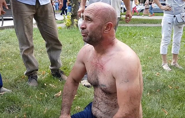 Самосожжение в Крыму: стало известно о состоянии активиста Самосожжение в Крыму: стало известно о состоянии активиста