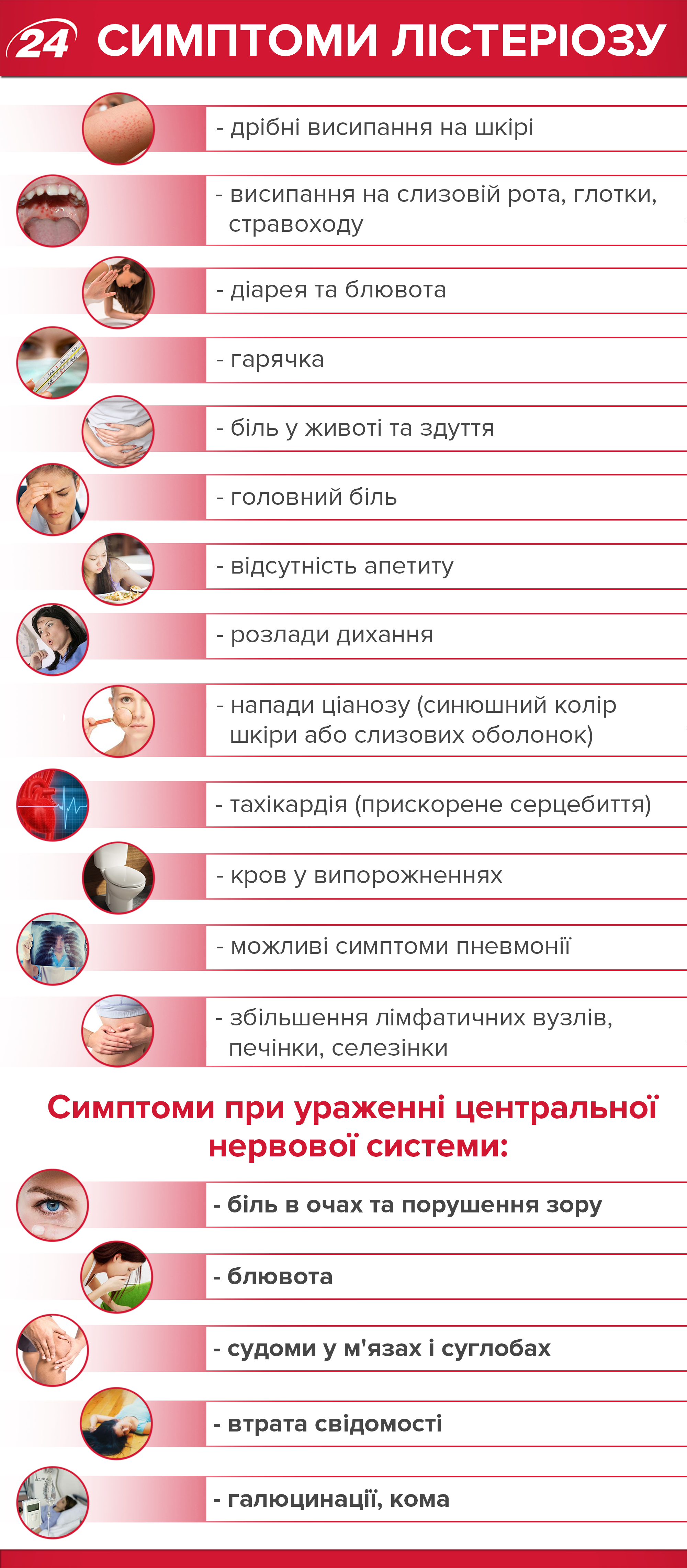 Лістеріоз в Україні: симптоми та лікування