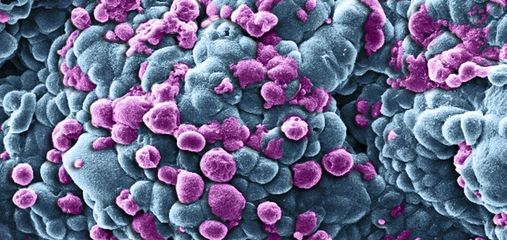 Вченим вдалось вперше записати миттєву смерть клітини: відео