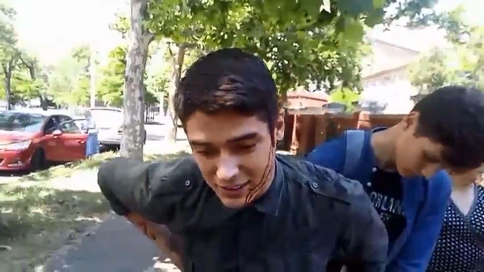 "Публичное давление действует": пострадавшему от нападения одесском активисту продлили госохрану "Публичное давление действует": пострадавшему от нападения одесском активисту продлили госохрану