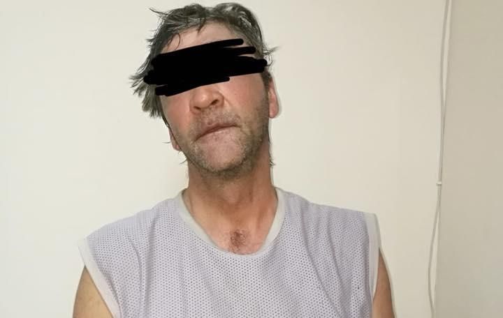 В Одесі чоловік облив дитину кислотою В Одесі чоловік облив дитину кислотою