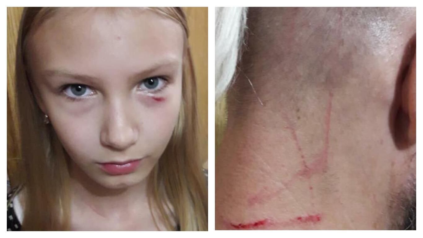 Почала бити в обличчя, голову та нирки: бабця накинулася на школярку та її батька у Києві  