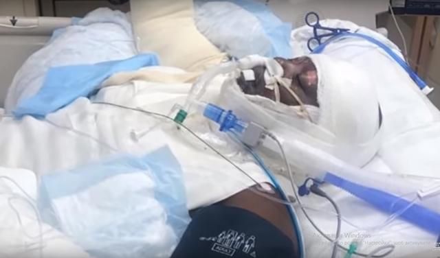 Флешмоб Fire challenge: пострадал ребенок - фото Флешмоб Fire challenge: пострадал ребенок - фото