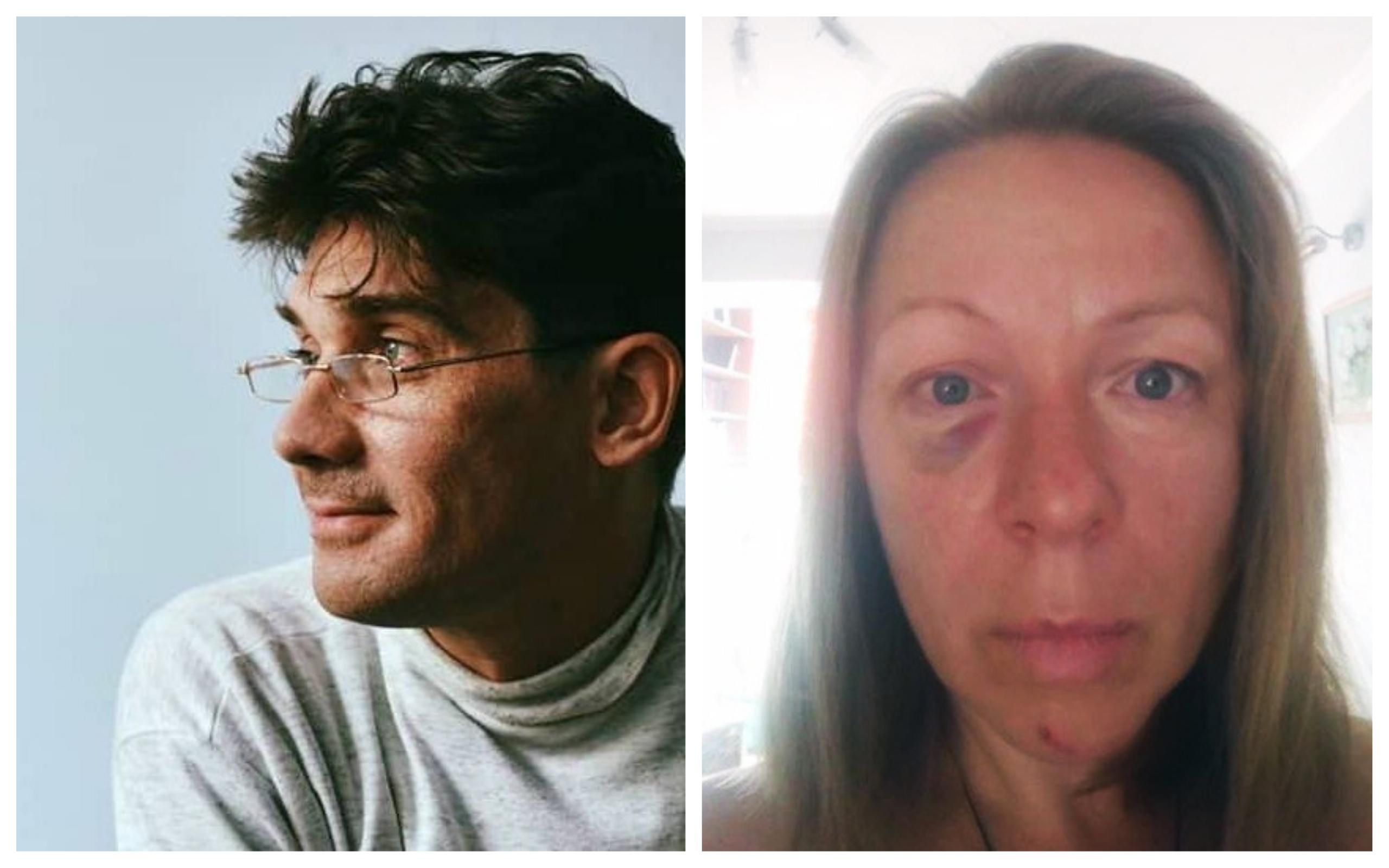 Актер из "Сватов" побил сожительницу и похвастался этим в соцсетях: фото Актер из "Сватов" побил сожительницу и похвастался этим в соцсетях: фото