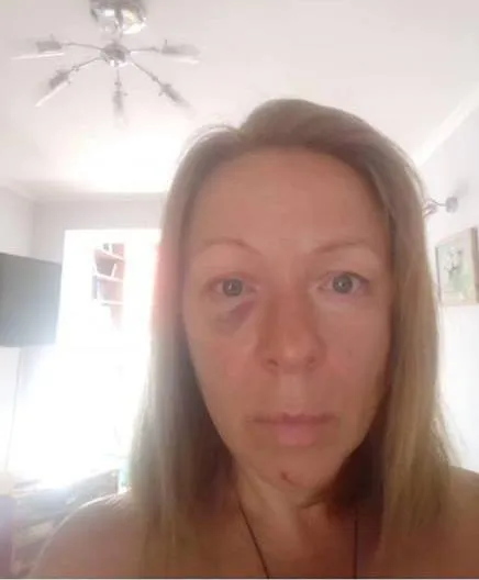 Олена Савченко Кошелєв побиття актор Олена Савченко Кошелєв побиття актор