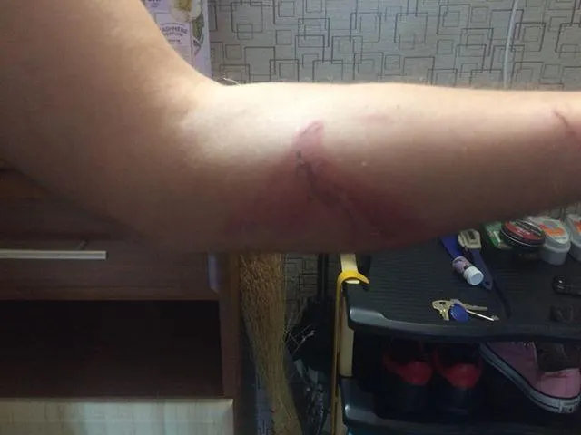 Одеса ДТП фонтан постраждалий Одеса ДТП фонтан постраждалий