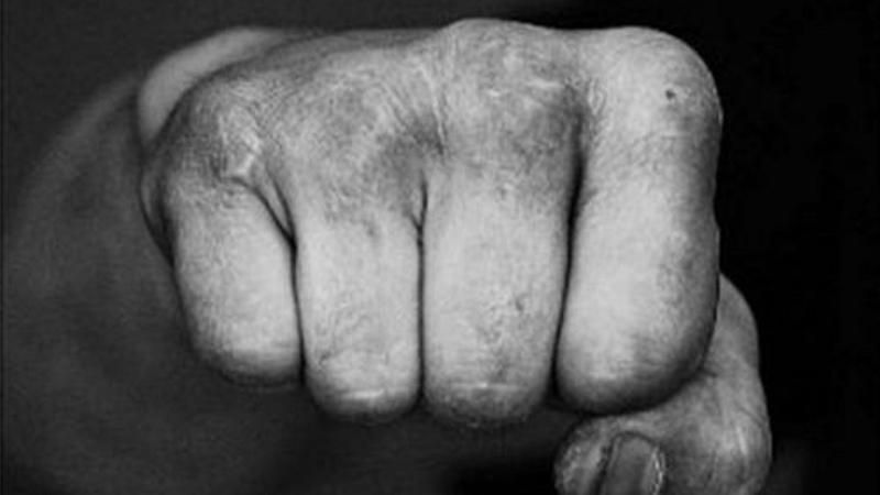 У Греції побили депутата від керівної партії через угоду з Македонією У Греції побили депутата від керівної партії через угоду з Македонією