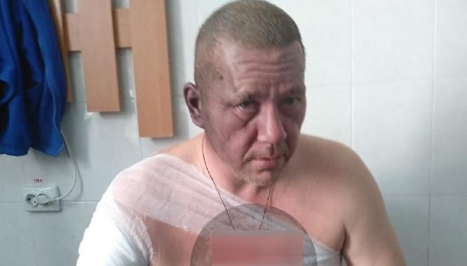 Взрыв в Донецке: появилось фото пострадавшего "кандидата" на должность главаря боевиков Взрыв в Донецке: появилось фото пострадавшего "кандидата" на должность главаря боевиков