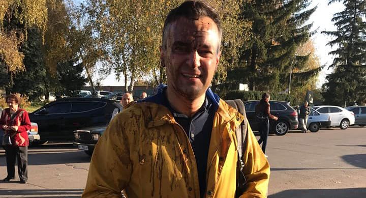 На журналиста Дмитрия Гнапа вылили ведро нечистот на Полтавщине: подробности