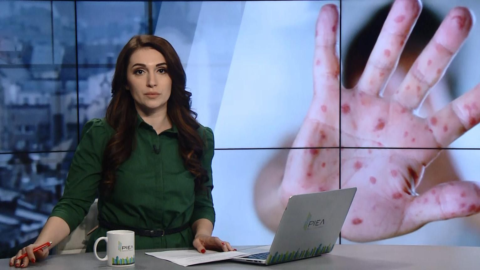 Випуск новин за 15:00: Кір в Україні. Псевдовибори бойовиків Випуск новин за 15:00: Кір в Україні. Псевдовибори бойовиків