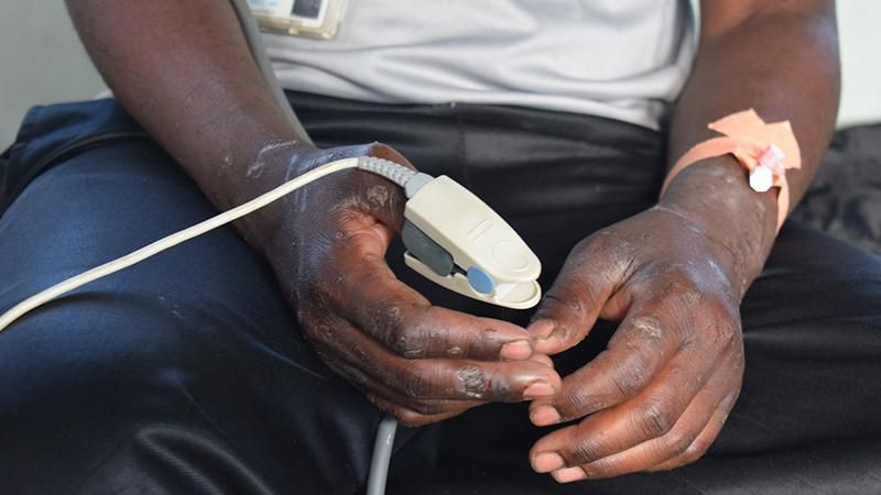 Українські військові врятували миротворця ООН у джунглях Конго: фото Українські військові врятували миротворця ООН у джунглях Конго: фото