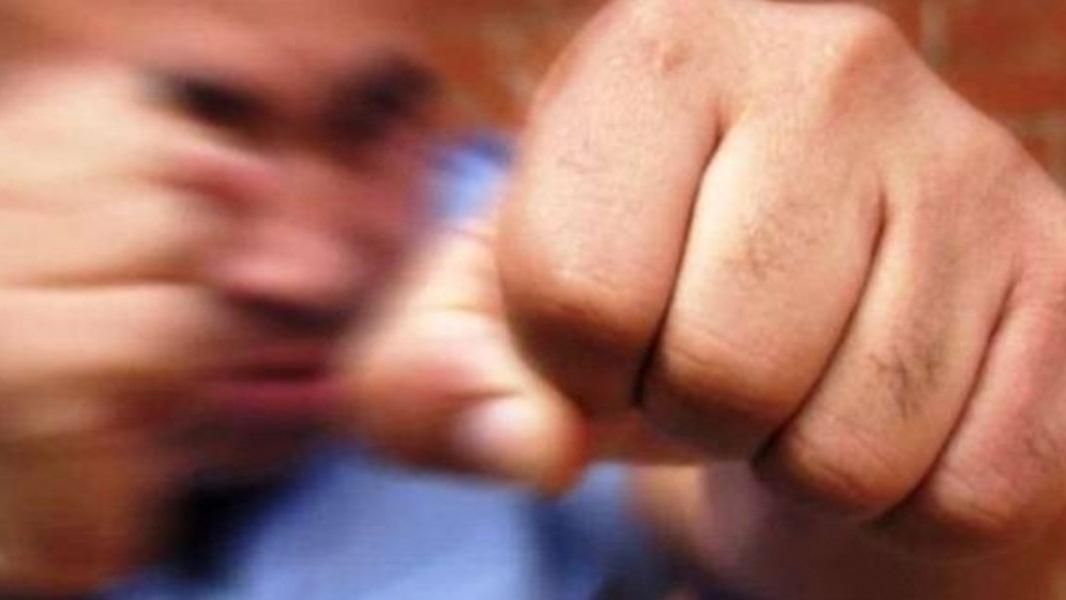 На Черниговщине депутат БПП налетел на пенсионера На Черниговщине депутат БПП налетел на пенсионера