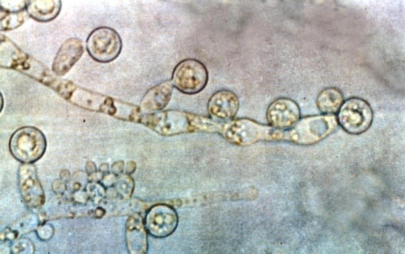 Грибок Candida albicans