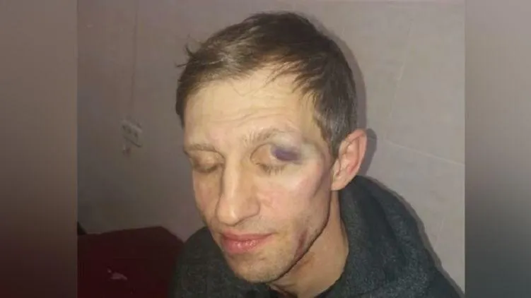У Києві батько побив вчителя У Києві батько побив вчителя