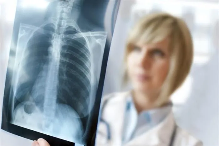 Лікар може призначити рентген органів грудної клітини