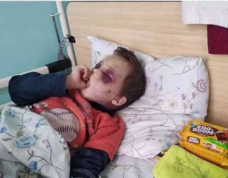 Звіряче побиття дитини на Вінничині, підозрюють батька Звіряче побиття дитини на Вінничині, підозрюють батька