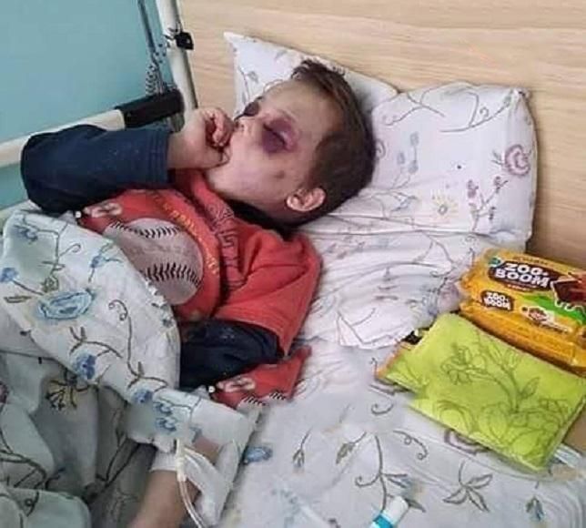 Жорстоке побиття малюка на Вінничині: прокуратура підозрює співмешканку його тата Жорстоке побиття малюка на Вінничині: прокуратура підозрює співмешканку його тата