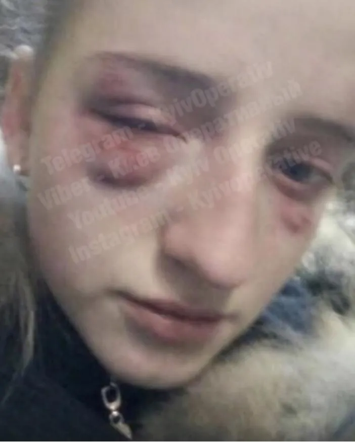 Київ булінг підлітки побиття дівчинка школярка Троєщина