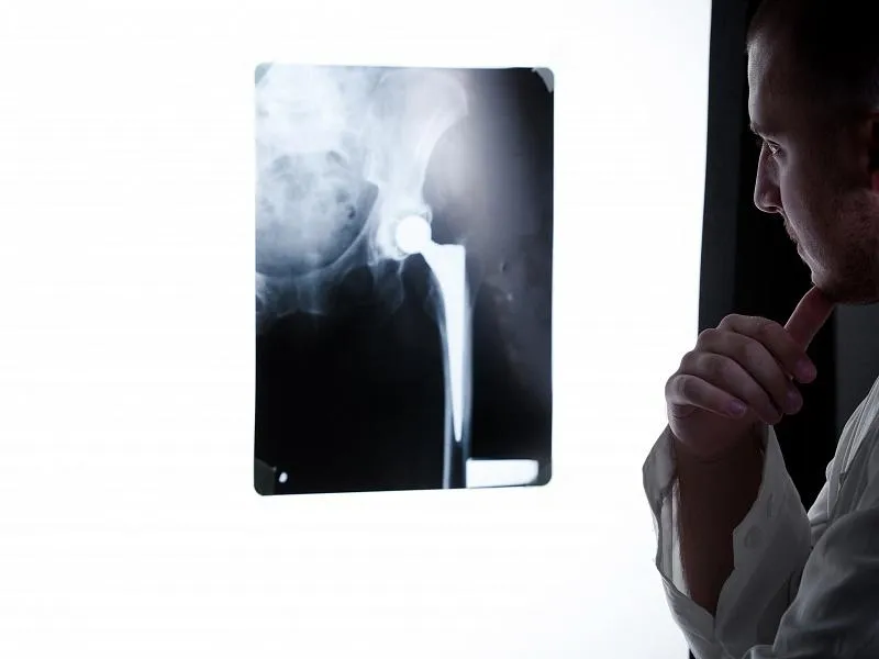 Лікар відправить на рентген, щоб виявити який у вас тип травми Лікар відправить на рентген, щоб виявити який у вас тип травми