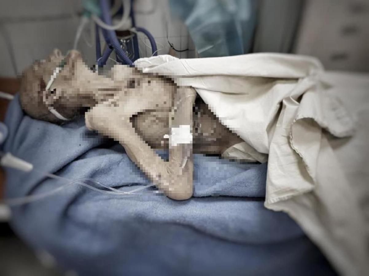В Днепре умерла женщина, которую привезли в больницу в состоянии комы третьей степени: фото 18+
