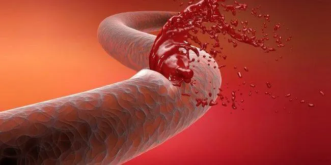 Гемофілія – порушує зв'язування крові 