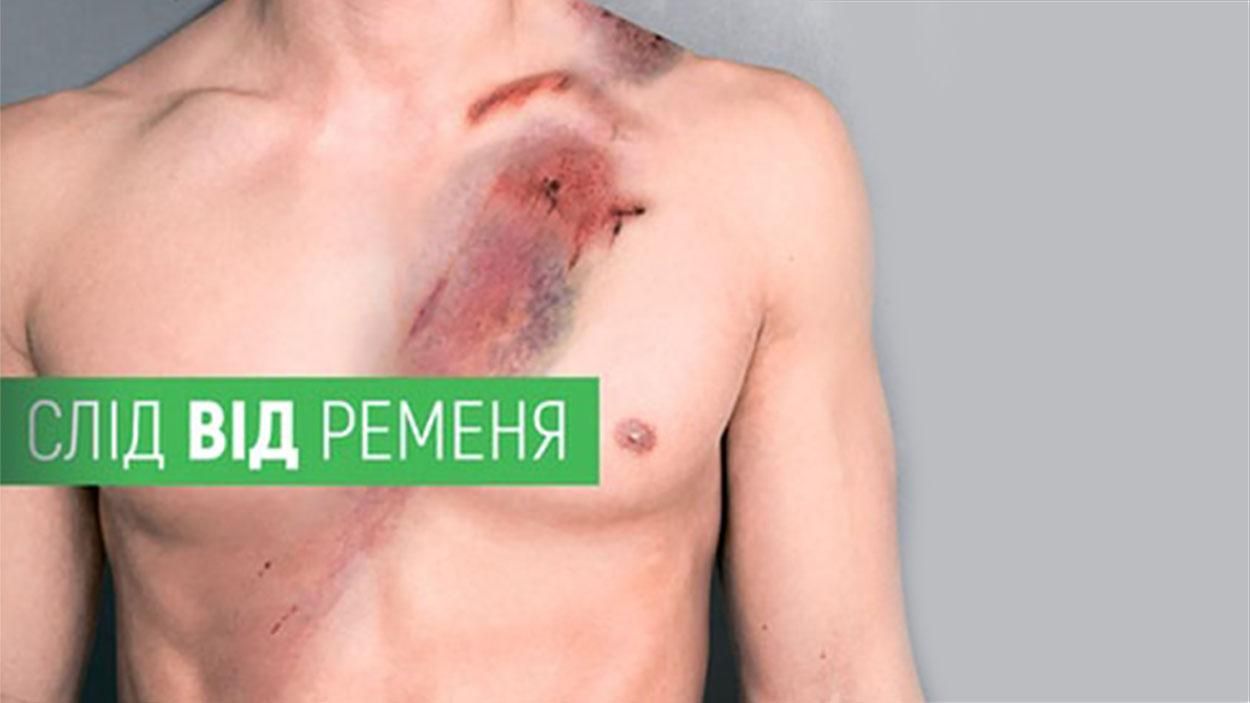 Сколько украинцев погибает без ремня безопасности: шокирующая статистика Сколько украинцев погибает без ремня безопасности: шокирующая статистика