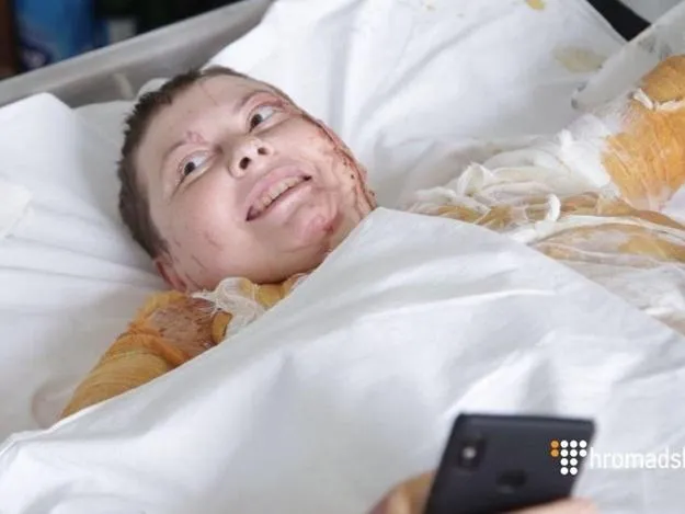 Катерина Гандзюк після нападу Катерина Гандзюк після нападу