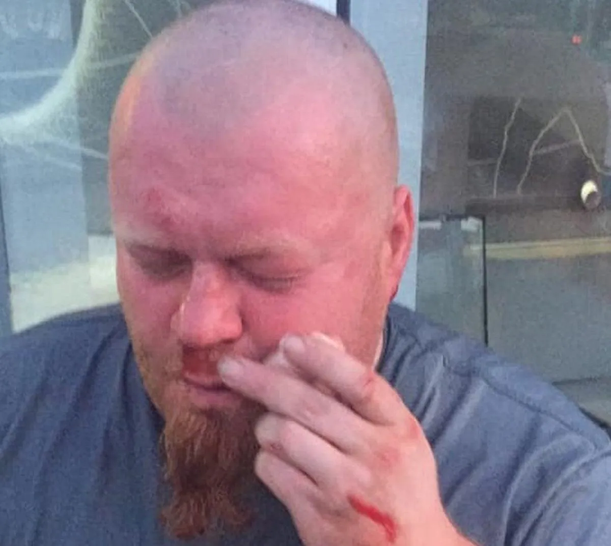 Оператора 24 каналу побили під час зйомок