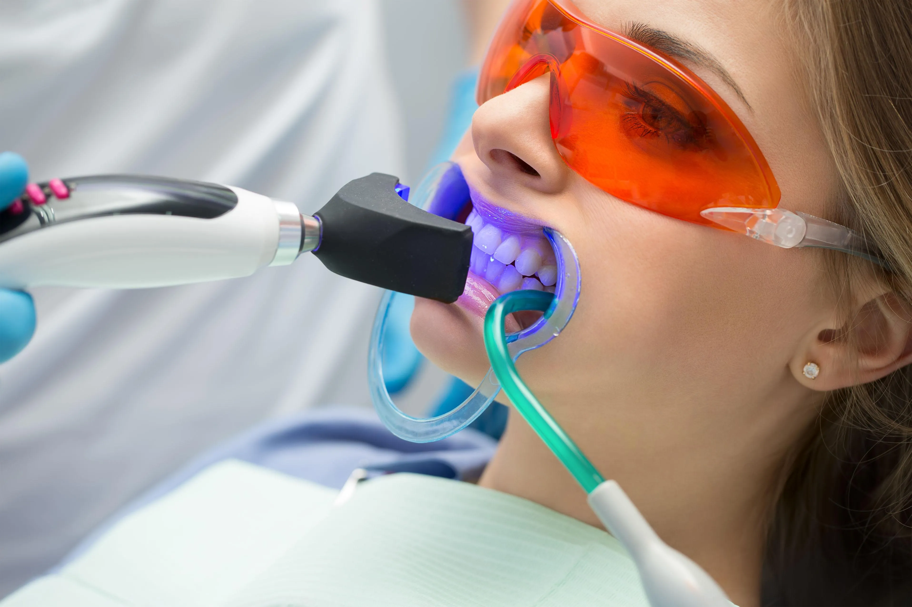 Методы отбеливания зубов. Лазерное отбеливание зубов. Отбеливание зубов ультрафиолетом. Отбеливание зубов в стоматологии.