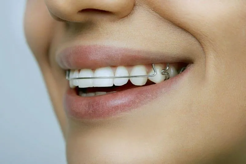 Неправильний прикус може призвести до рухливості зубів