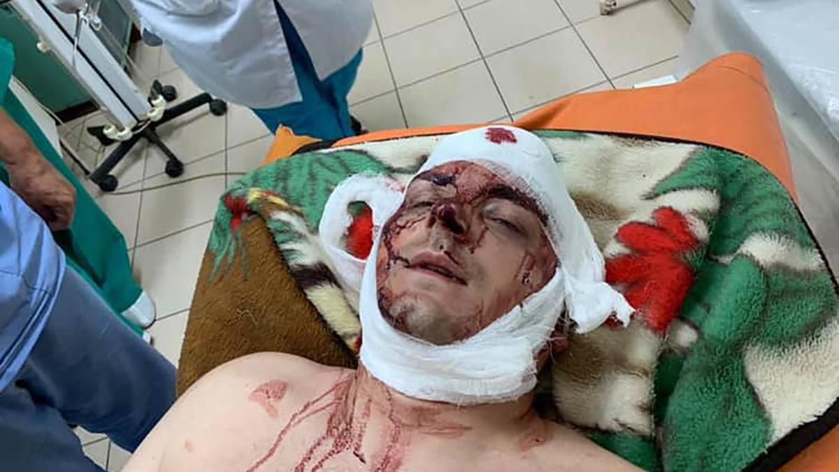 Артем Семенихин жестоко избит на Сумщине - экс-мэр Конотопа