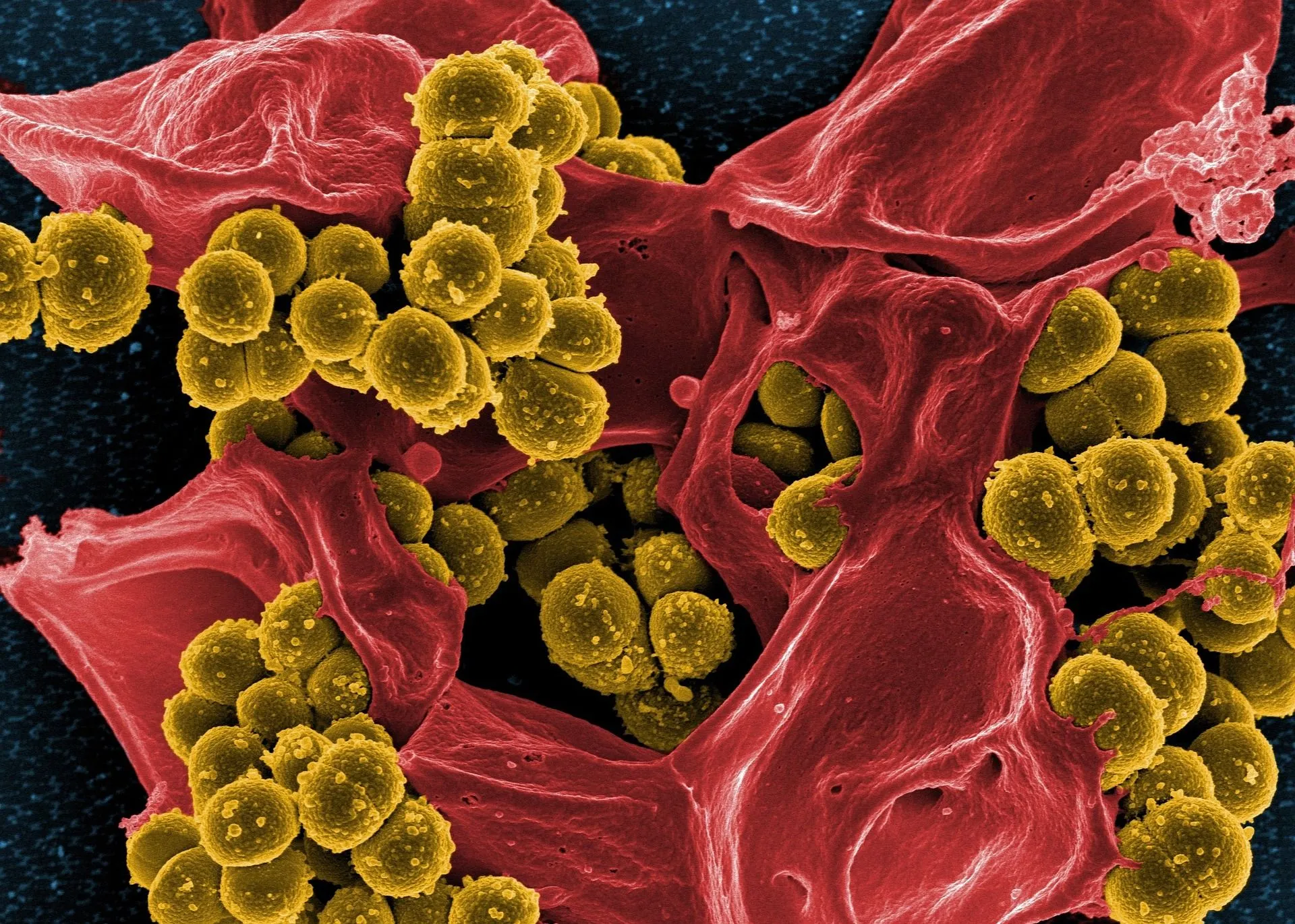 Бактерії змогли повністю знищити рак 